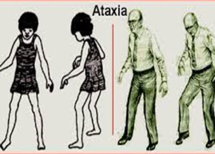 ¿Qué es la Ataxia?
